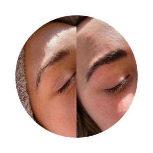 brow lamination before and after